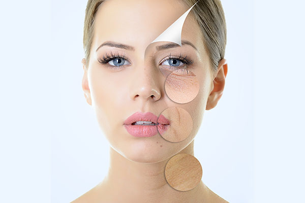 Mesoterapia Facial