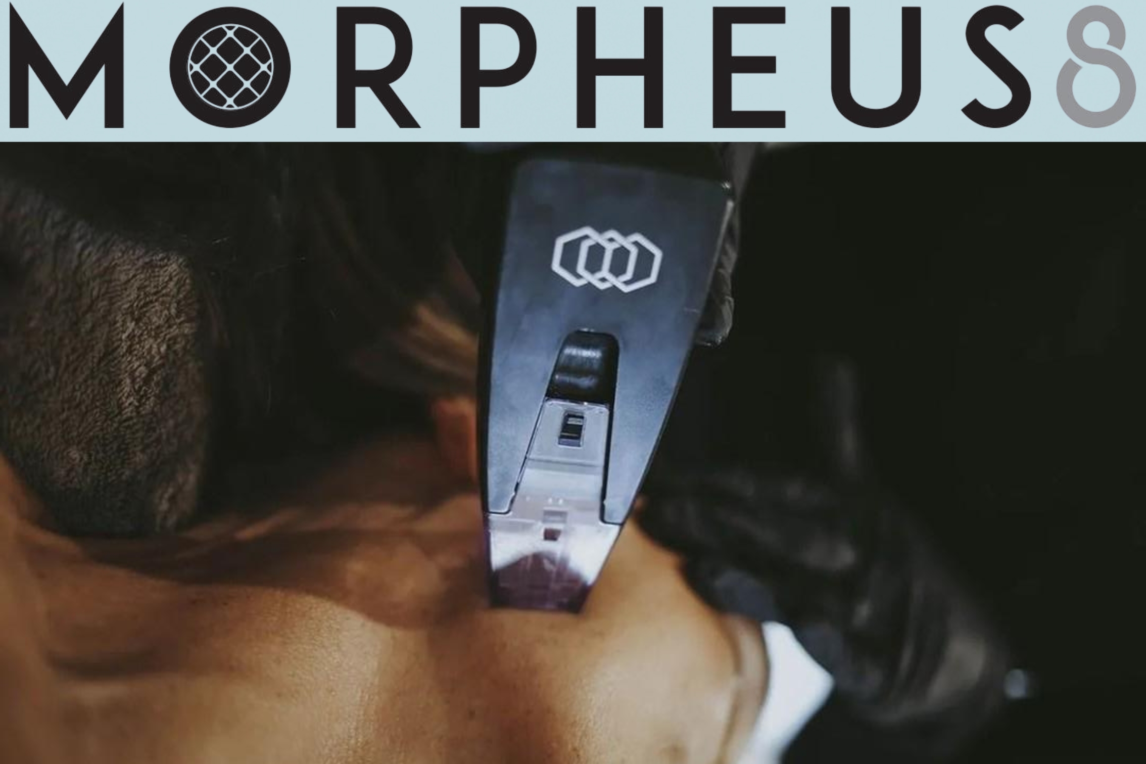 MOR DESCR morpheus 8